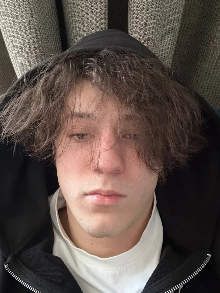 Selfie of GladiatorGG on Telegram, looking visibly sick and apologizing for missing the stream due to illness.